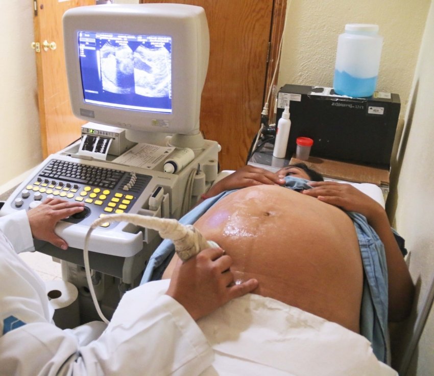 Hidalgo avanza contra el embarazo adolescente