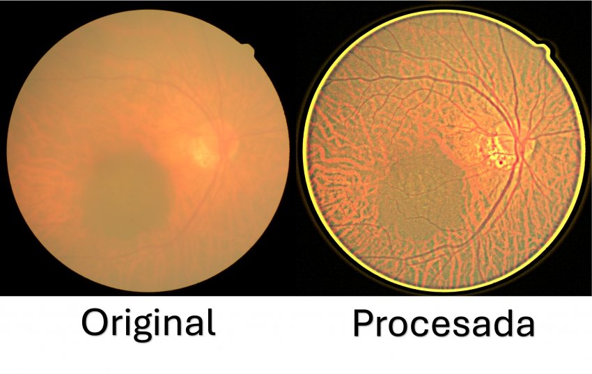 Desarrolla UPT sistema de bajo costo para mejorar imágenes de retina
