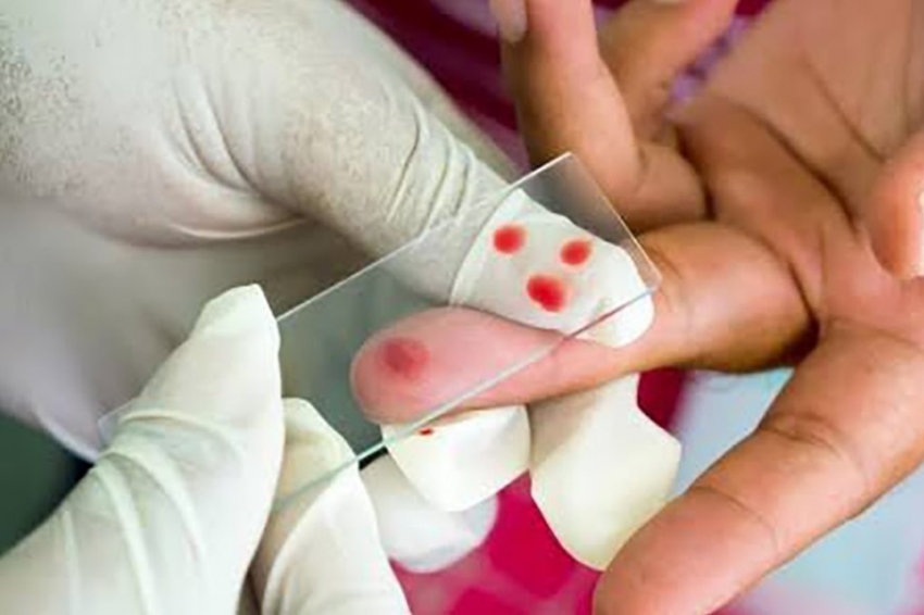 Desde 1999, Hidalgo no registra casos de paludismo, por lo que se considera un padecimiento eliminado