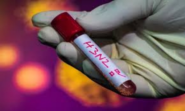 Detectan primer caso de gripe asociada al virus H3N2