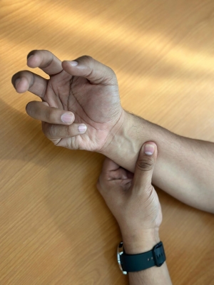 El estado se mantiene una vigilancia epidemiol&oacute;gica de Par&aacute;lisis Fl&aacute;cida Aguda